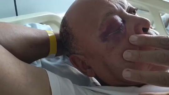Idoso é agredido com socos no rosto após carro bater em veículo que dirigia em São Paulo 