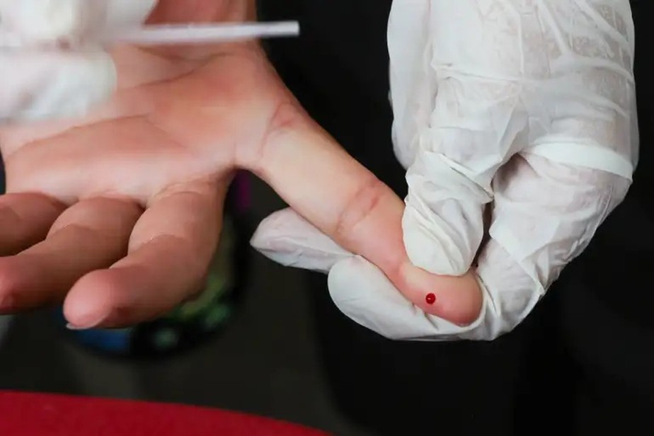 Brasil elimina transmissão vertical do HIV e registra menor mortalidade em  anos