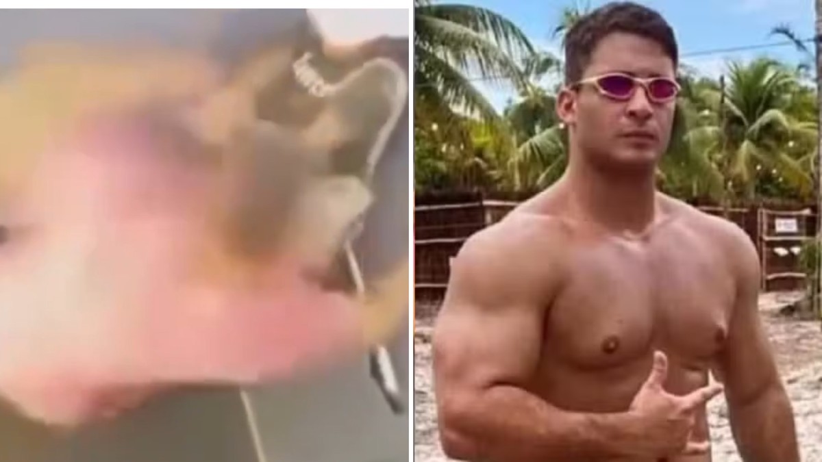 Ver a imagem de origem